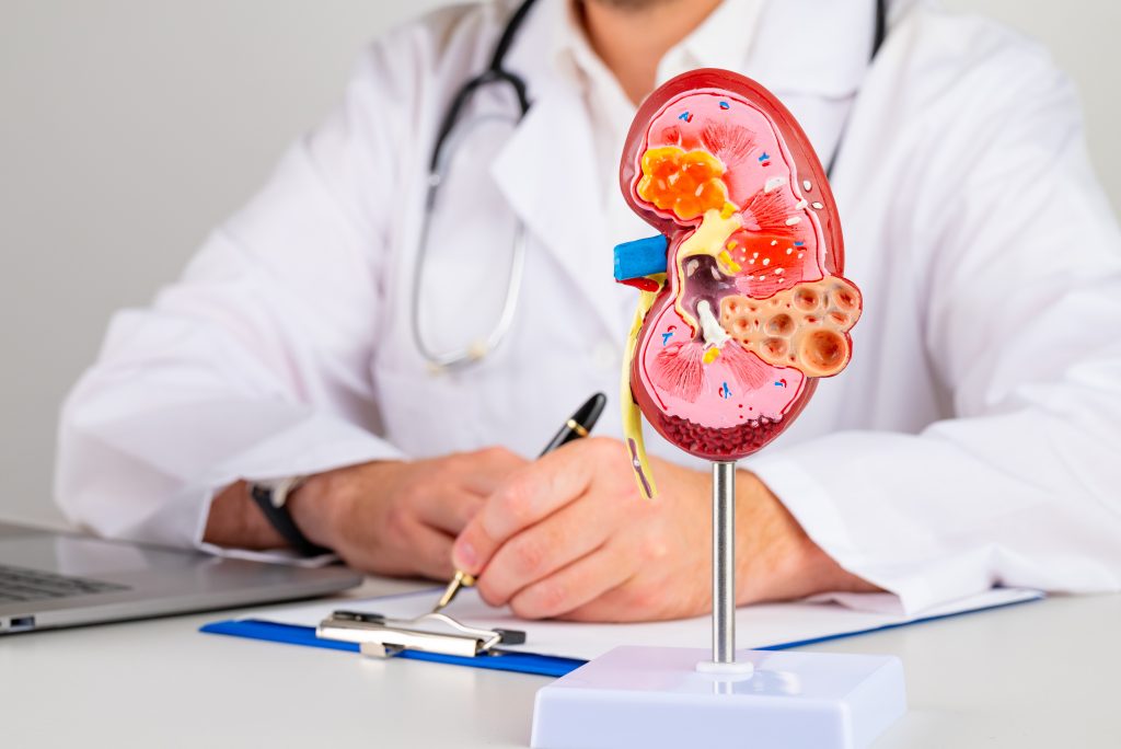 Cirurgia para Cálculo Renal em São Paulo e Sorocaba | Dr. Cristovão Neto